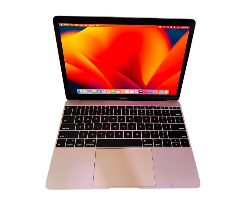 MacBook Screen Calibration and Repair in Kampala: TrueTone & Retina Fix - featured image at MicroStar Andy Kampala